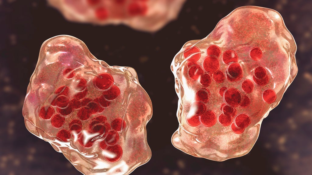 Central Minnesota county reports "several cases of suspected measles" — WCCO / CBS Minnesota, Fridley Health news